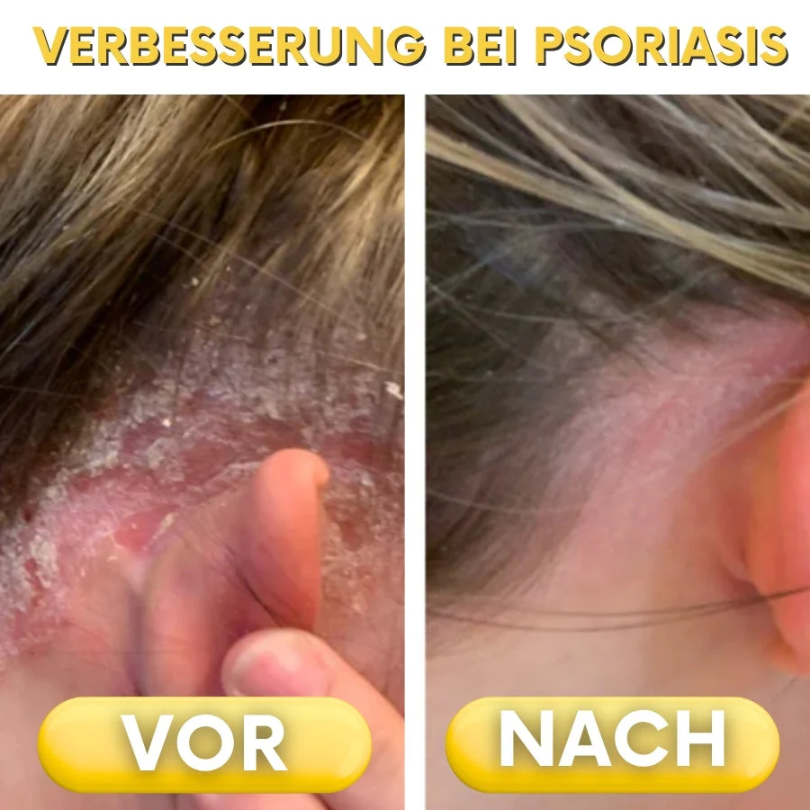 Vorschaubild 8